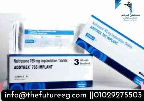 غرسات نالتريكسون تحت الجلد
