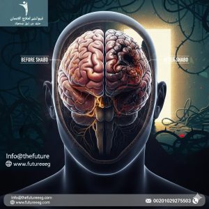 أعراض إدمان الشبو على المخ: الضرر العصبي الناتج عن إدمان الكريستال ميث