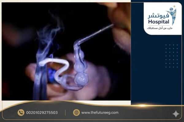 الشبو والقيادة والحوادث
